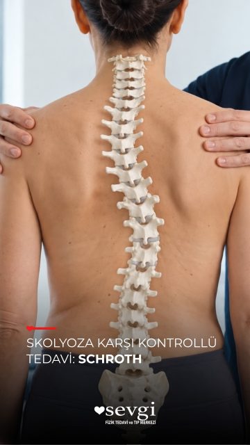 Skolyozda egzersiz herkese aynı şekilde mi uygulanır?
Schroth yöntemi, skolyoza özel geliştirilmiş; kişinin eğrilik yapısına göre planlanan, postür, nefes ve kontrollü düzeltme egzersizlerini bir araya getiren bir yaklaşımdır.
Amaç yalnızca hareket etmek değil; kişinin omurga yapısına uygun şekilde vücut farkındalığını, duruş kontrolünü ve günlük yaşam içindeki doğru pozisyonlanmayı desteklemektir.
📌 Skolyozda egzersiz programı kişiye özel planlanmalıdır.
📲 Skolyoz tanısı olan veya bu konuda bilgi arayan bir yakınınız varsa videoyu onunla paylaşabilirsiniz.
📍 Detaylı değerlendirme için Sevgi Fizik Tedavi ve Rehabilitasyon Tıp Merkezi ile iletişime geçebilirsiniz.
#Skolyoz #Schroth #SchrothTedavisi #SkolyozEgzersizleri #FizikTedavi