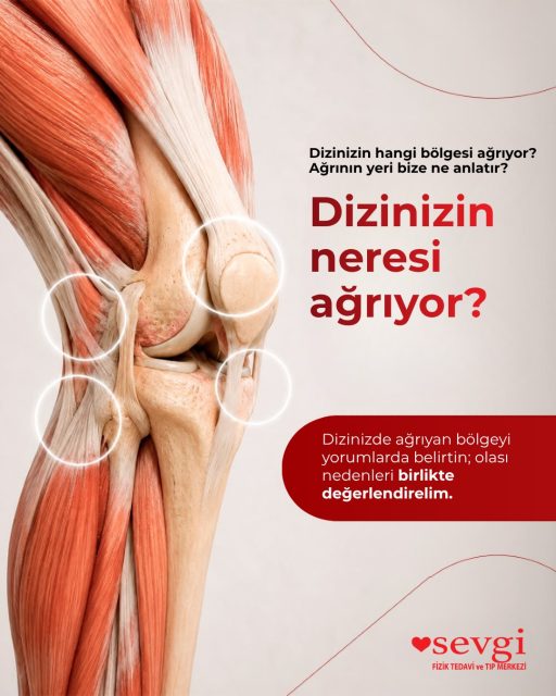 Dizinizin neresi ağrıyor? Ağrının yeri, nedenine dair önemli ipuçları verebilir. 🦵
 
Diz ağrısı; dizin ön, iç, dış veya arka bölümünde hissedilebilir ve her bölgedeki ağrının nedeni farklı olabilir. Ancak yalnızca ağrının bulunduğu bölgeye bakarak kesin tanı koymak mümkün değildir.

Ağrının ne zaman başladığı, hangi hareketlerle arttığı ve eşlik eden şikâyetler değerlendirilerek doğru yaklaşım belirlenir.

📌 Sizin diziniz en çok nerede ağrıyor?

 Yorumlarda ön / iç / dış / arka olarak bizimle paylaşın. 👇

#SevgiFizikTedavi #DizAğrısı #FizikTedavi #DizSağlığı #Ortopedi #Fizyoterapi #DizRehabilitasyonu