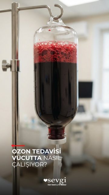 Ozon tedavisi vücutta nasıl çalışıyor? 💉

Ozon tedavisinde uygulama şekli ve tedavi planı, kişinin ihtiyacına ve hekim değerlendirmesine göre belirlenir.

Peki ozonun nasıl uygulandığını ve tedavi sürecinde neden tercih edilebildiğini biliyor muydunuz?

🎥 Videoda uygulamanın temel mantığını anlattık.
💬 Ozon terapiyi daha önce duymuş muydunuz?
📲 Merak eden bir yakınınızla paylaşabilir, daha sonra tekrar izlemek için kaydedebilirsiniz.

📍 Sevgi Fizik Tedavi ve Rehabilitasyon Tıp Merkezi

#OzonTerapi #OzonTedavisi #FizikTedavi #OzonTerapisi #OzonTedavisininFaydaları